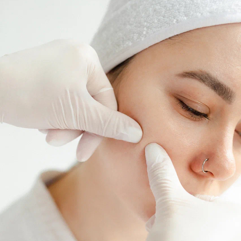 Чистка лица