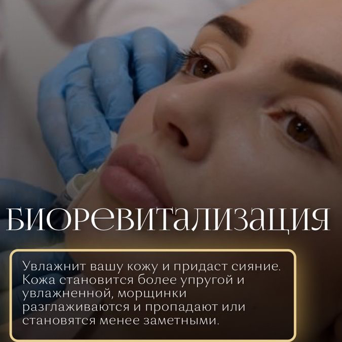 Биоревитализация