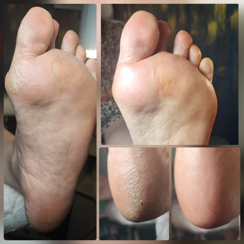 Педикюр (полный)