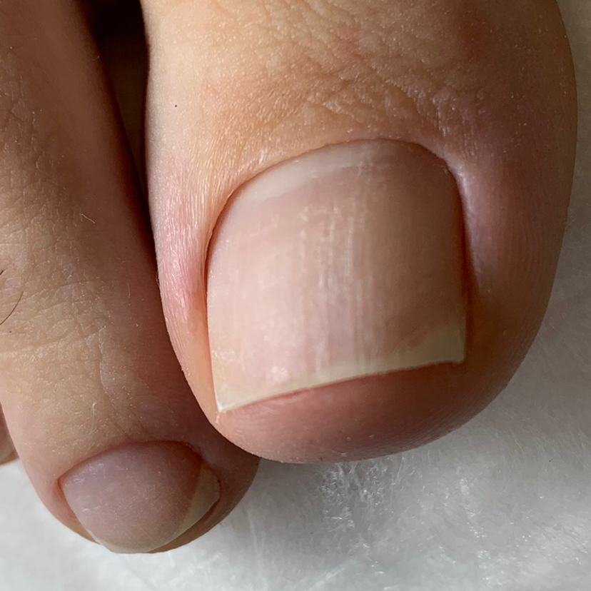 Гигиеническая обработка ногтей