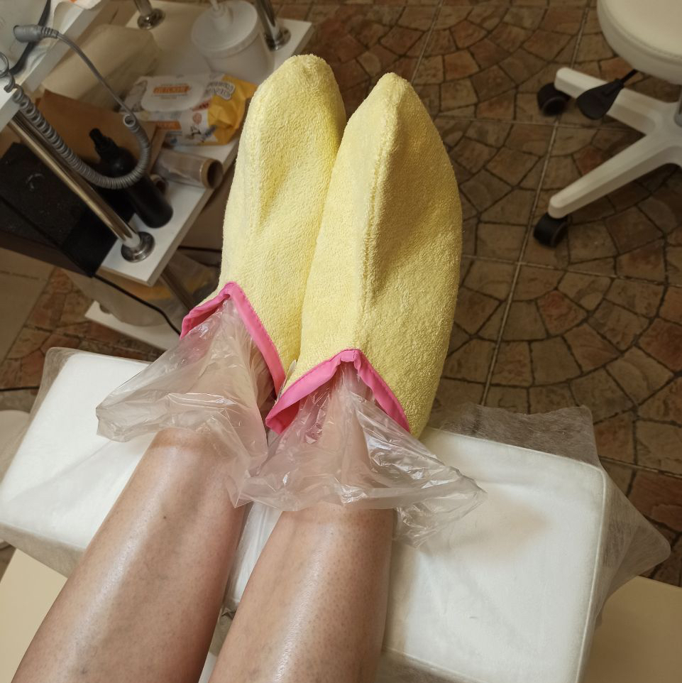 Парафинотерапия стоп