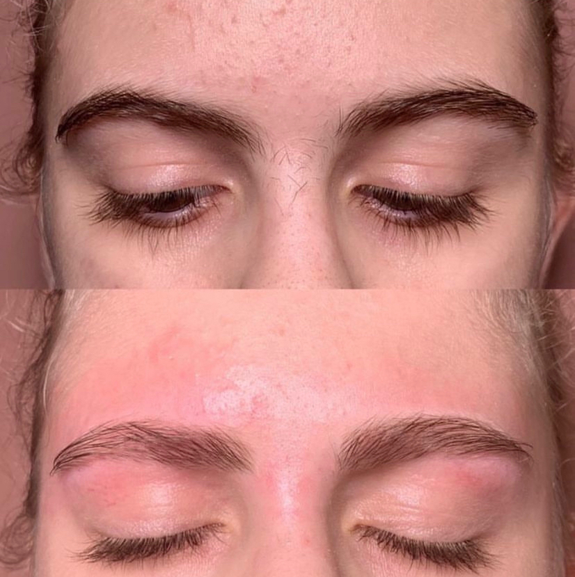 Прореживание бровей