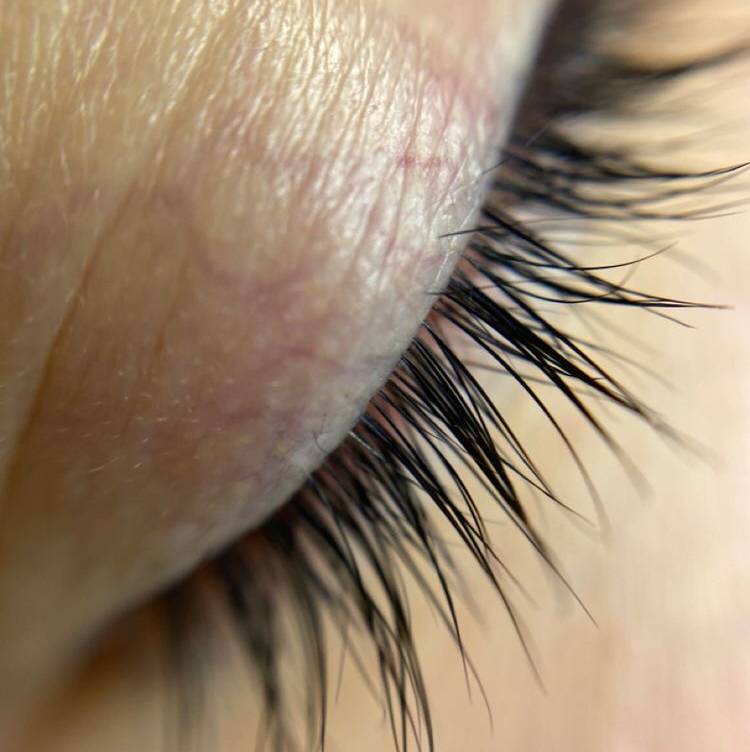 Снятие и восстановление ресниц