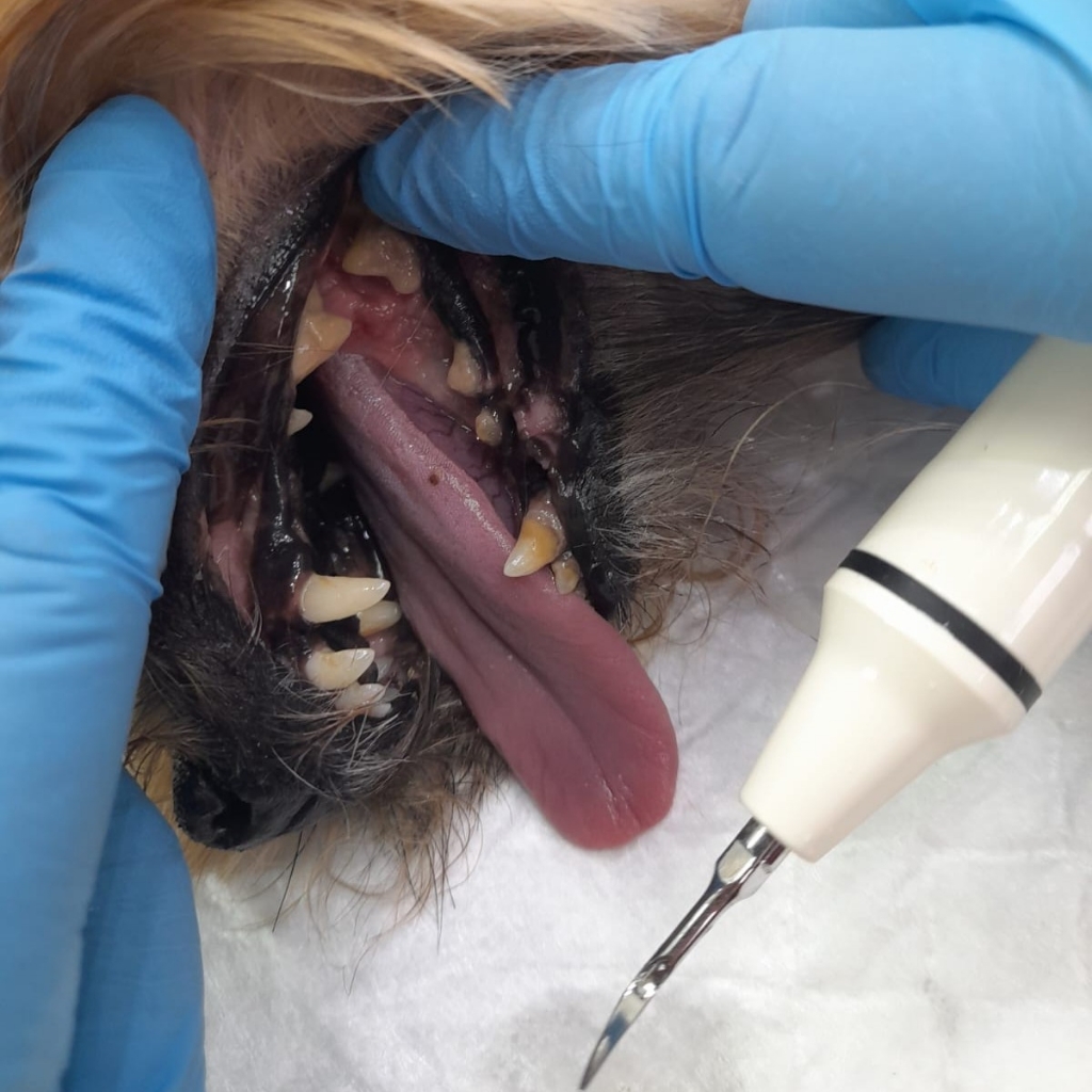 Чистка зубов ультразвуковым скалером под седацией.