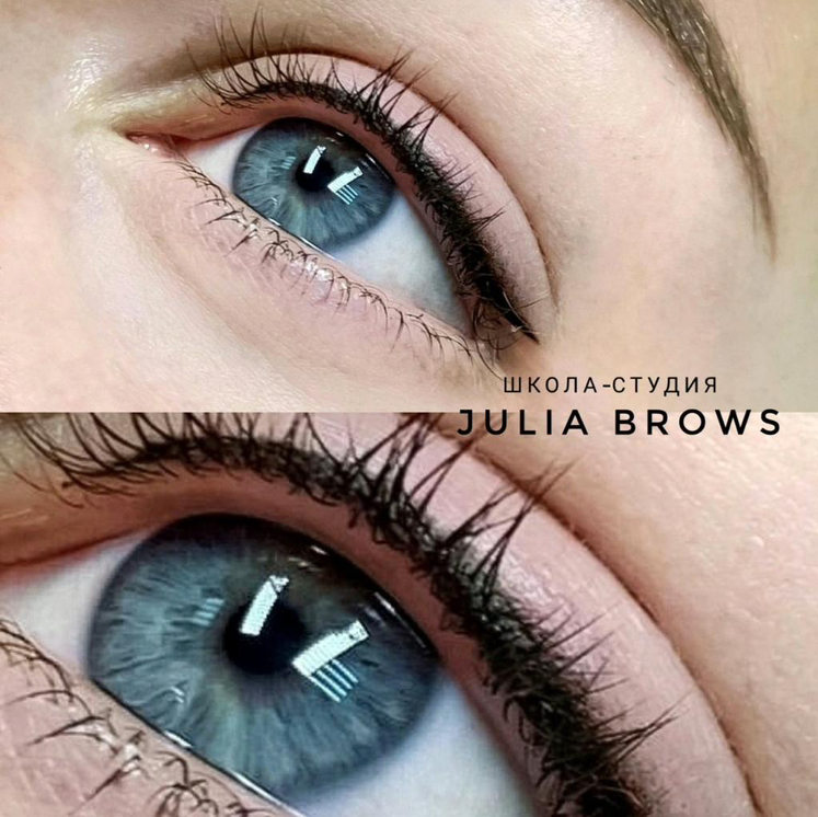 Межресничное пространство .