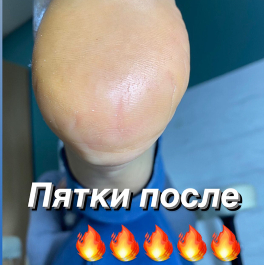 Смарт педикюр без покрытия