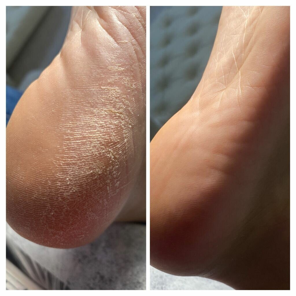 Smart педикюр без покрытия