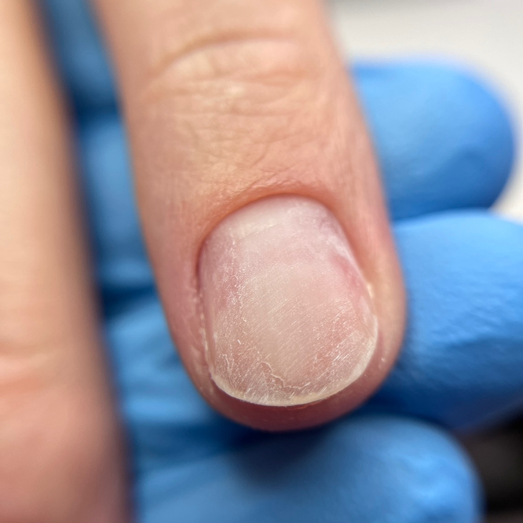 Полное снятие без маникюра