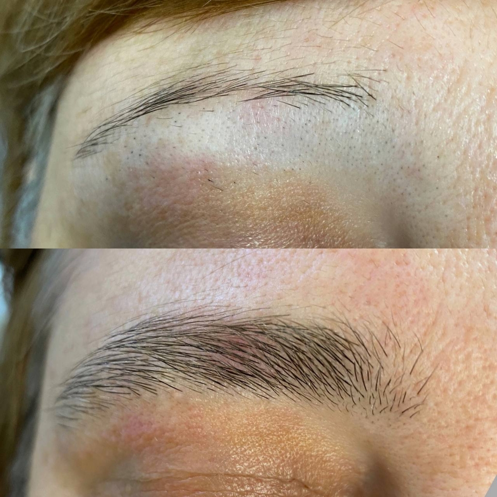 Реновационная коррекция бровей