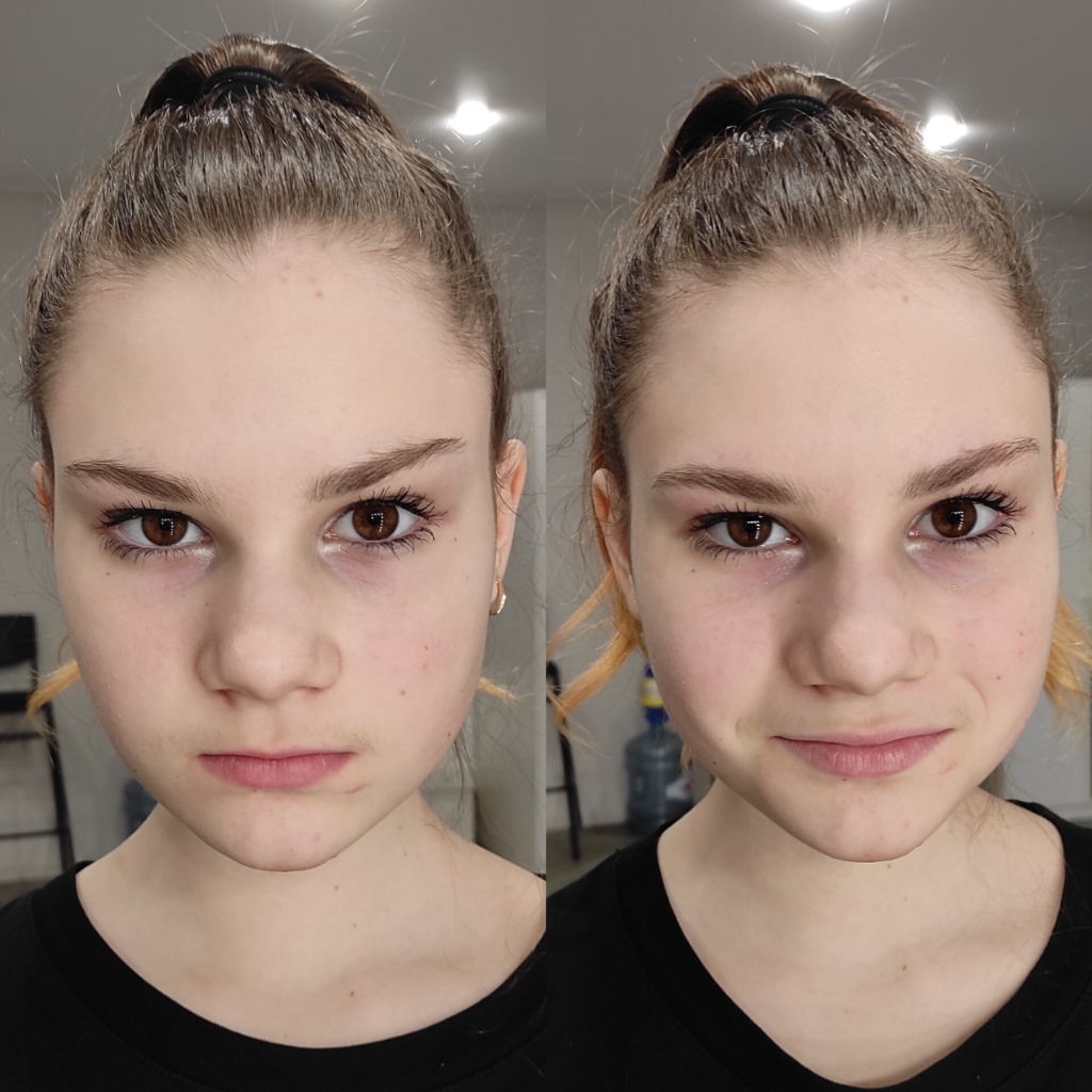 Подростковая коррекция