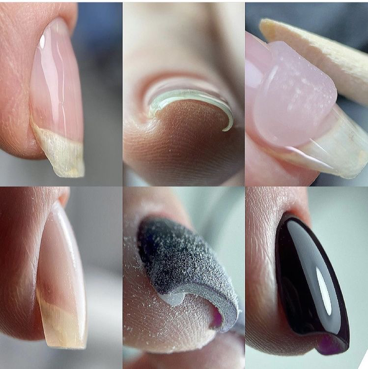 Маникюр со сложной коррекцией