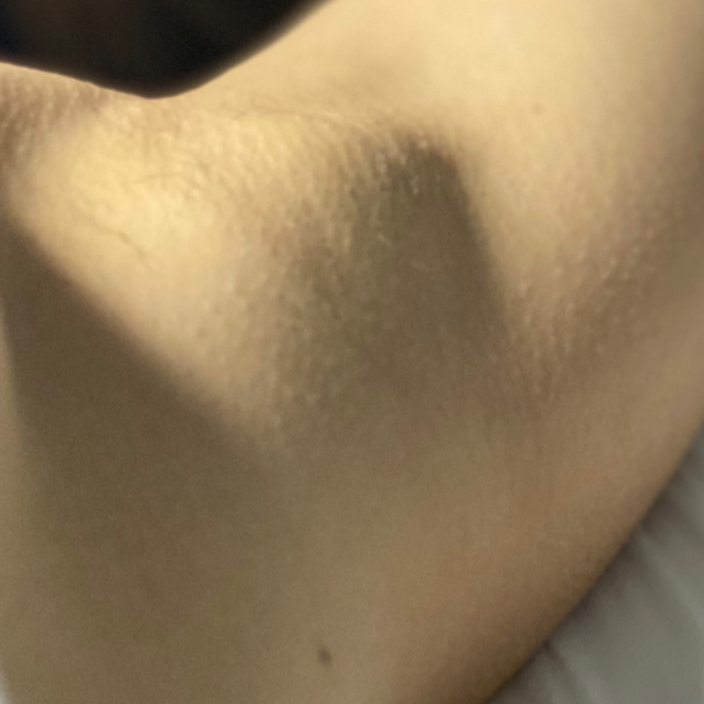 Подмышечные впадины