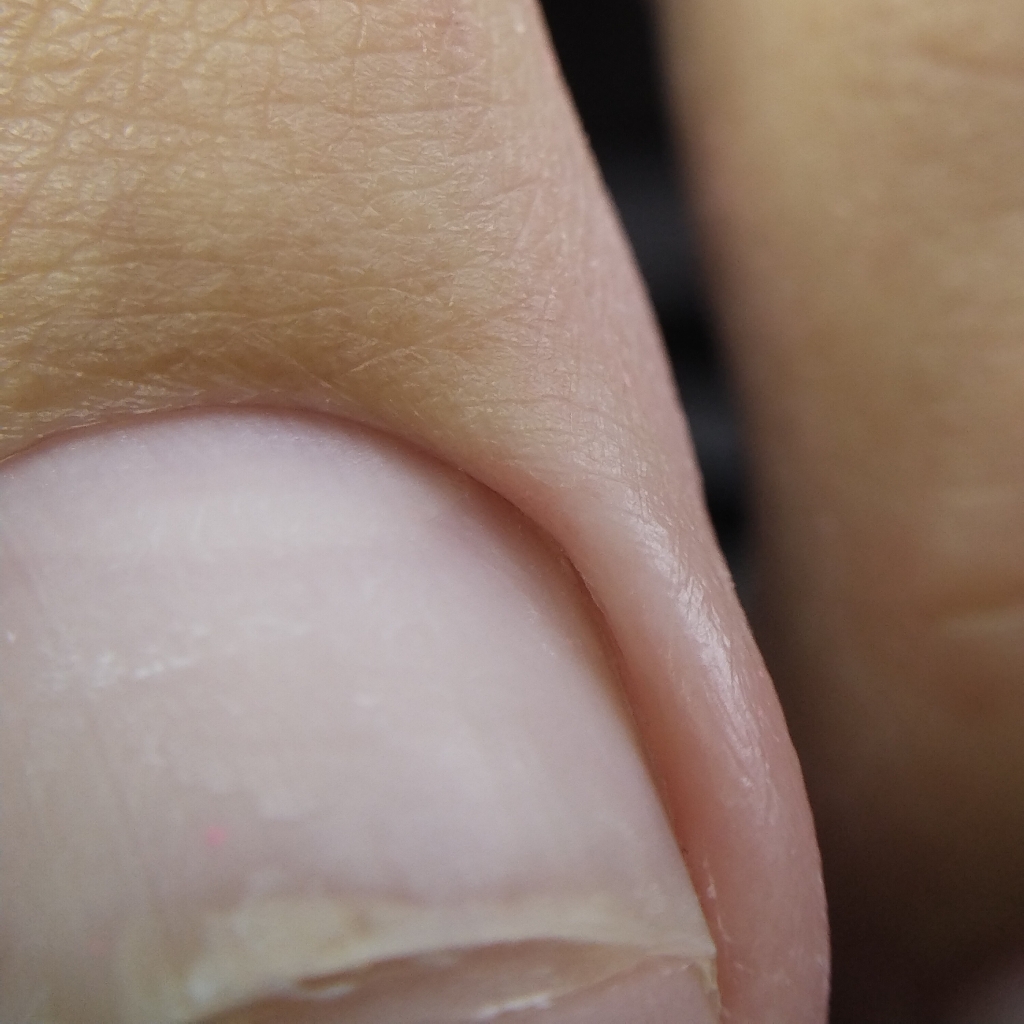 Педикюр "Только пальцы или только пятки "