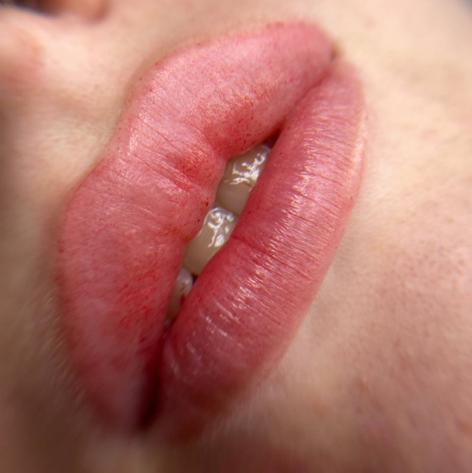 Перманент Губ