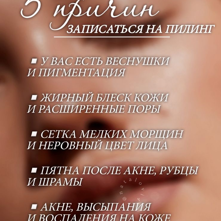 Химический пилинг