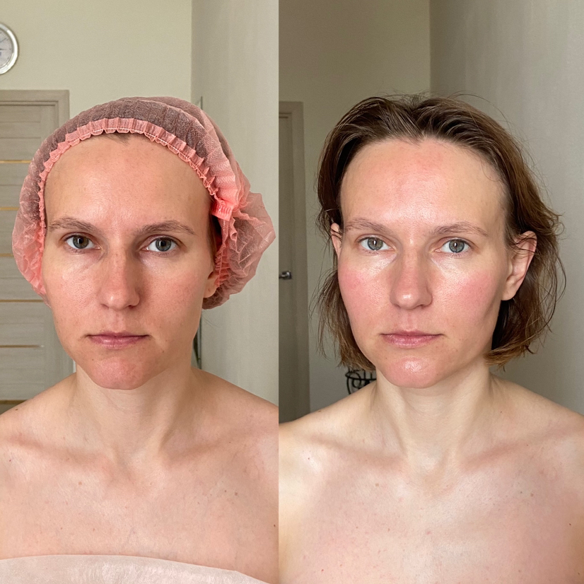 Хиромассаж / Испанский массаж