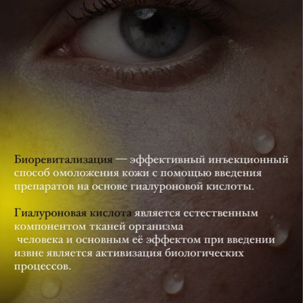 Биоревитализация