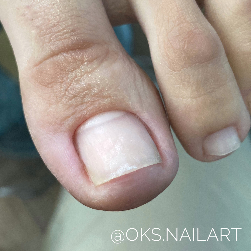 Гигиенический педикюр