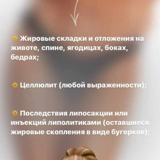 Кавитация живота 10 процедур -20%