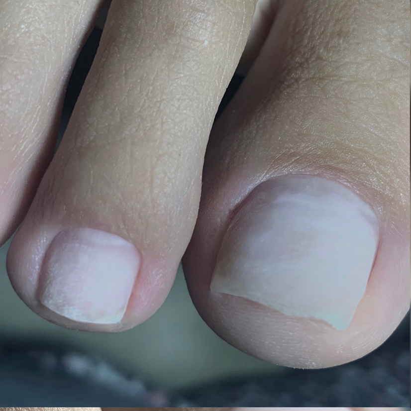 Педикюр без покрытия/ без пяток