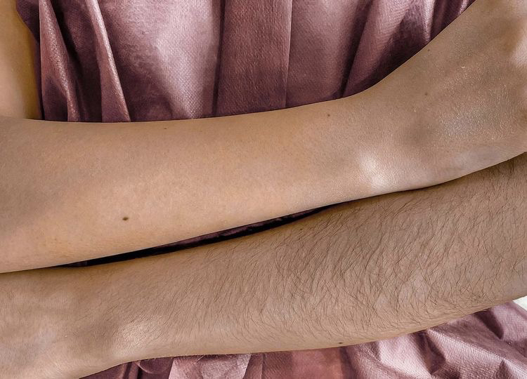 Руки до локтя(вкл.локоть)