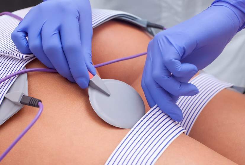 Миостимуляция