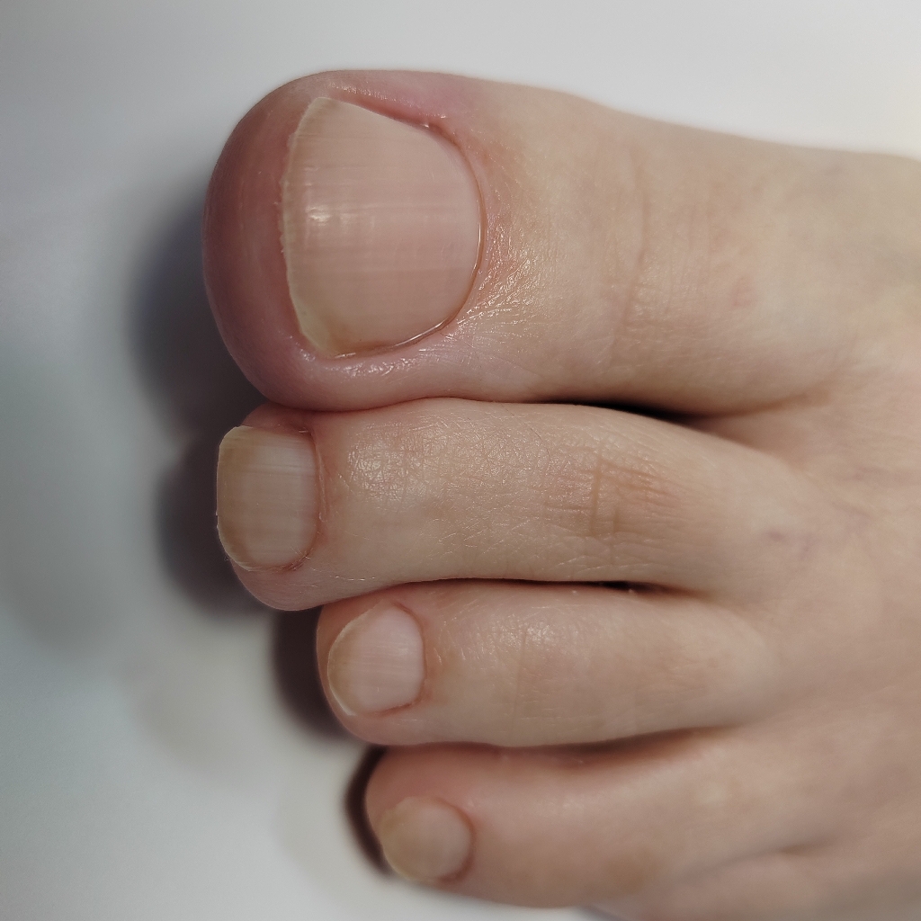 Обработка пальцев ног