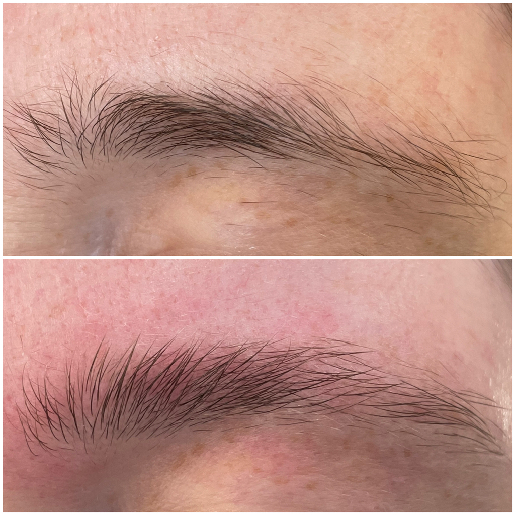 Smart коррекция бровей (пинцет)