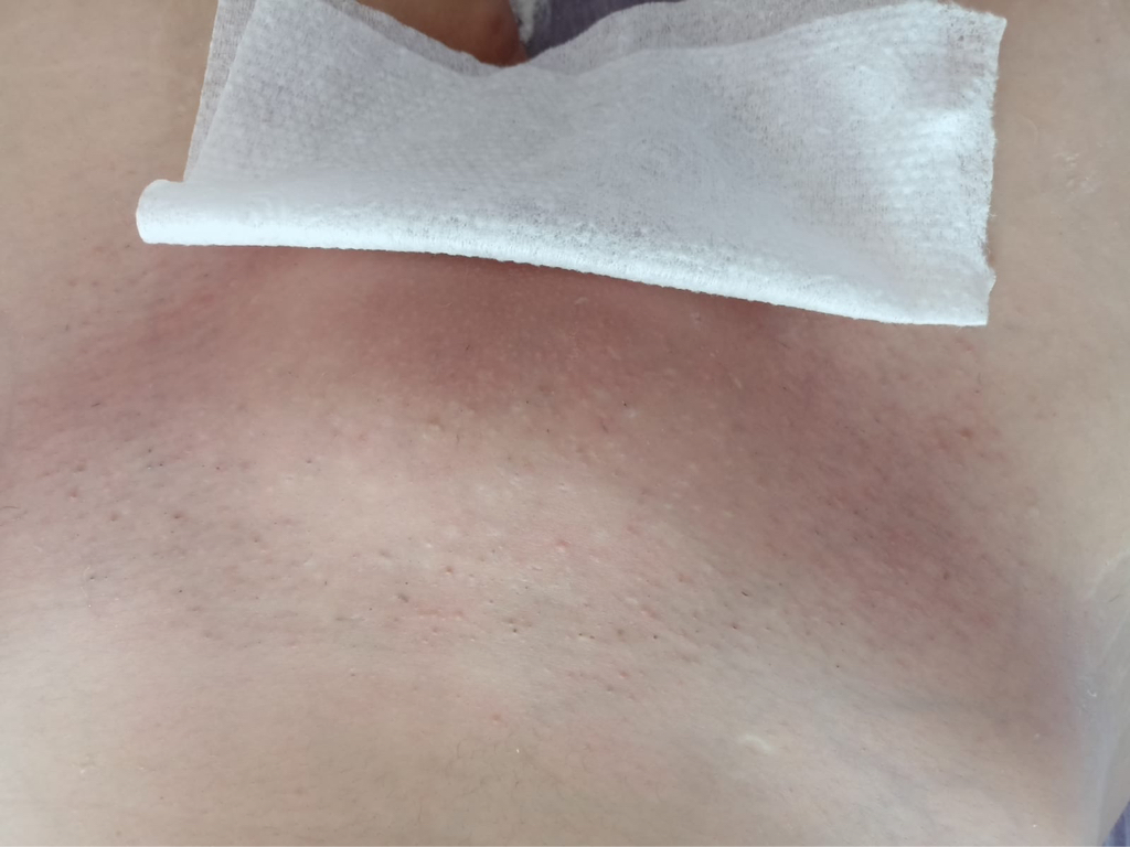 Глубокое бикини