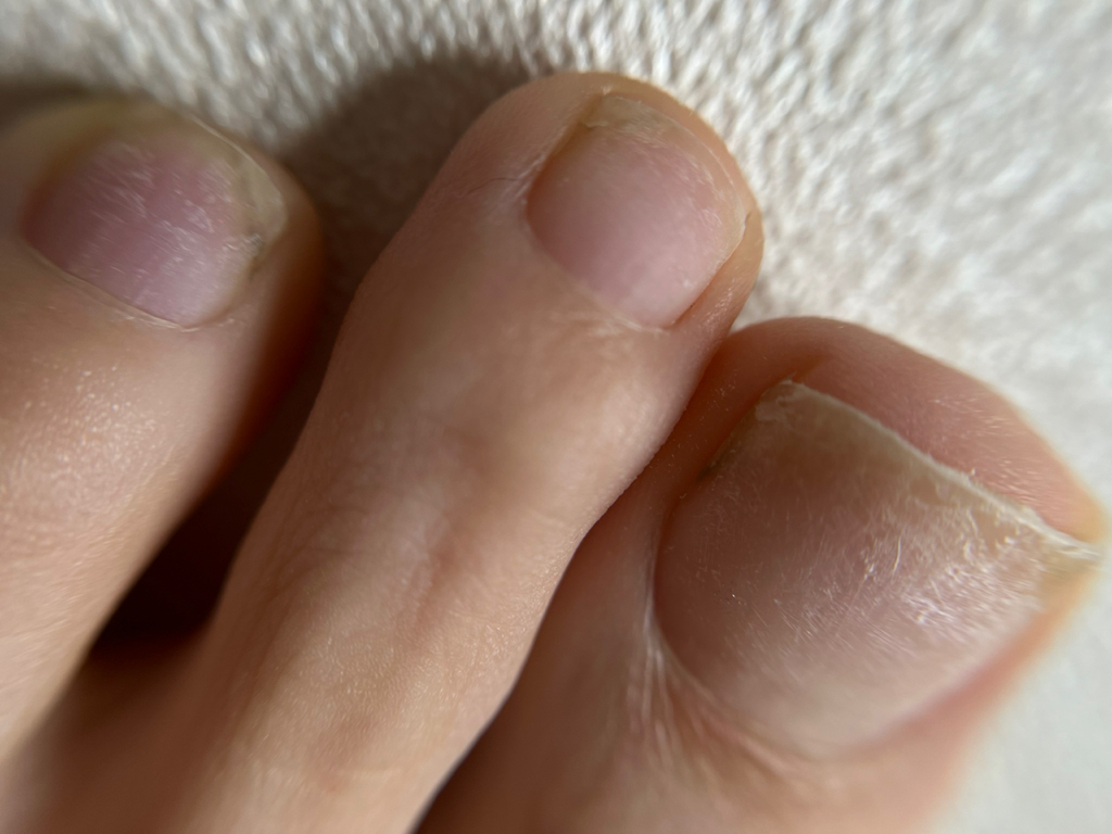 гигиеническая обработка пальцев