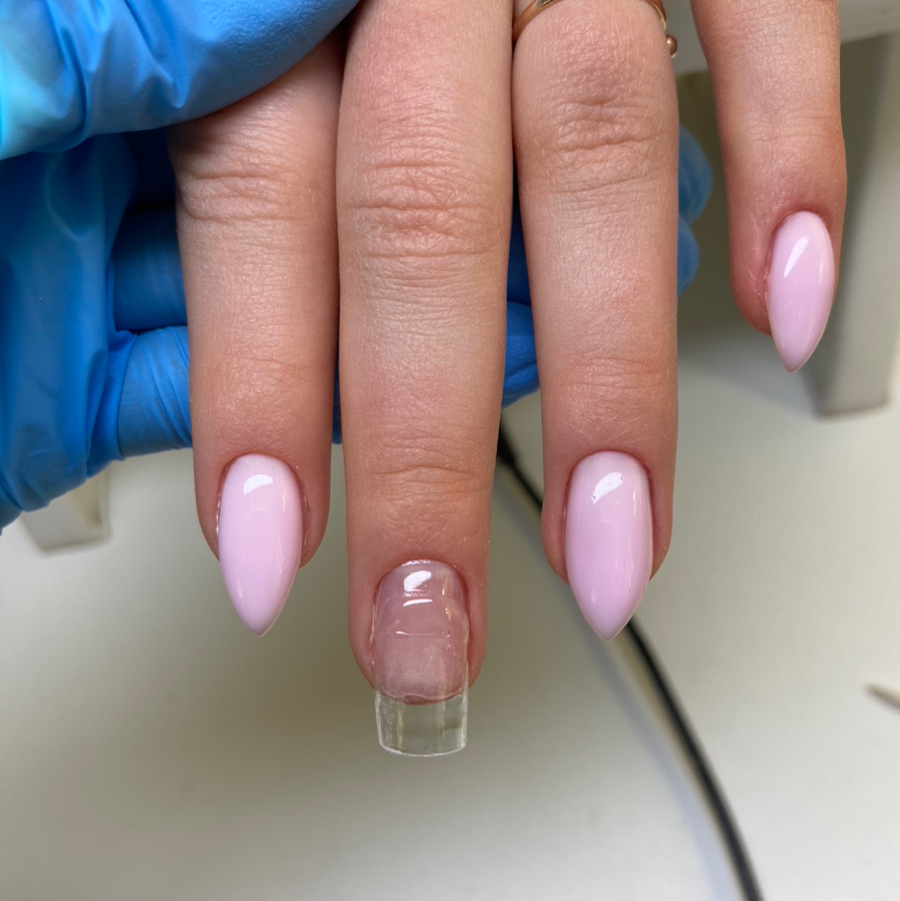 Ремонт ноготка