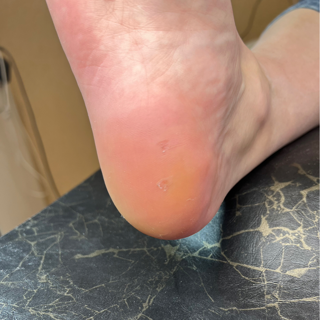 Педикюр Аппаратный