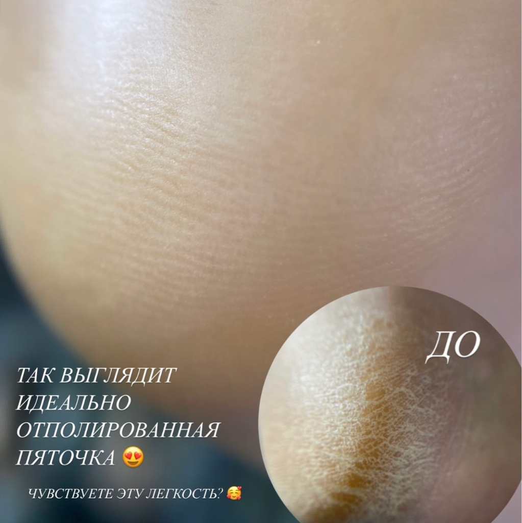 Полный гигиенический педикюр