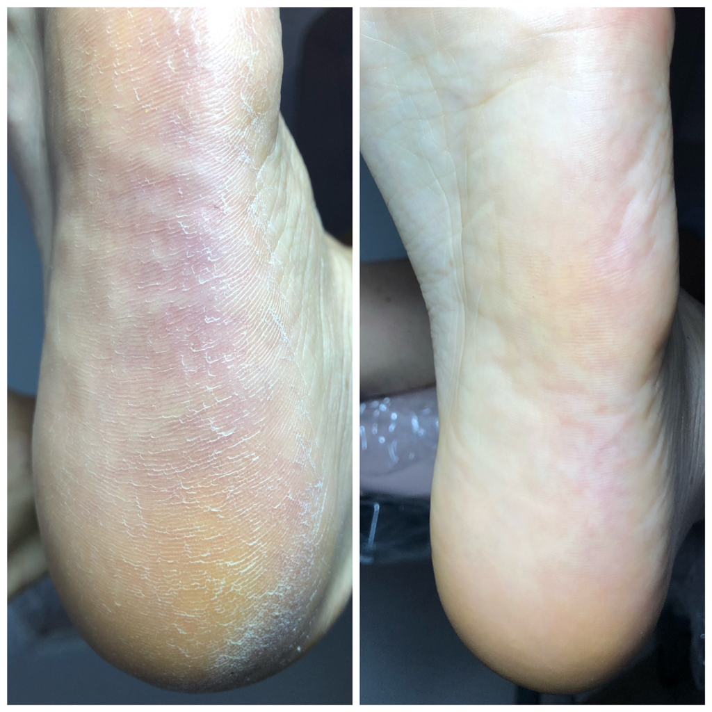 Педикюр. Обработка стопы и пальцев без покрытия