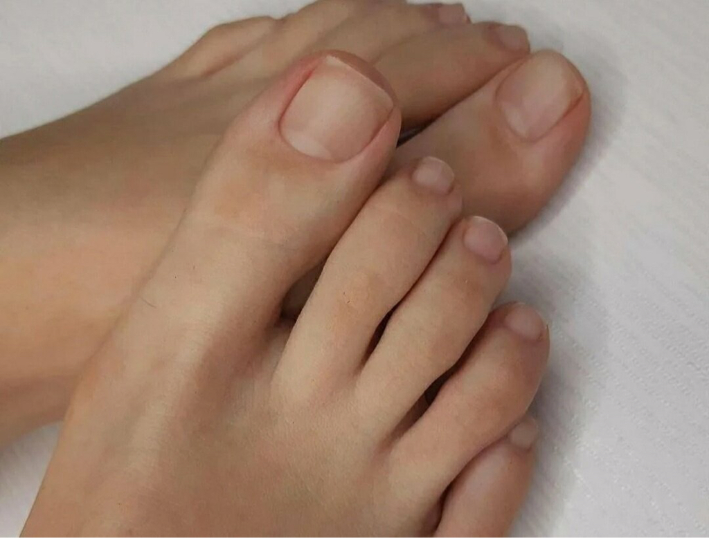 Аппаратный педикюр пальчики