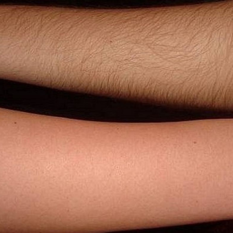 Депиляция: руки до локтя.