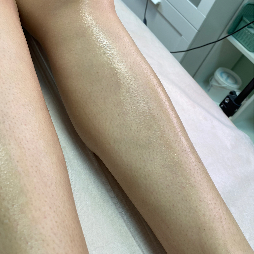 Голень / бедро