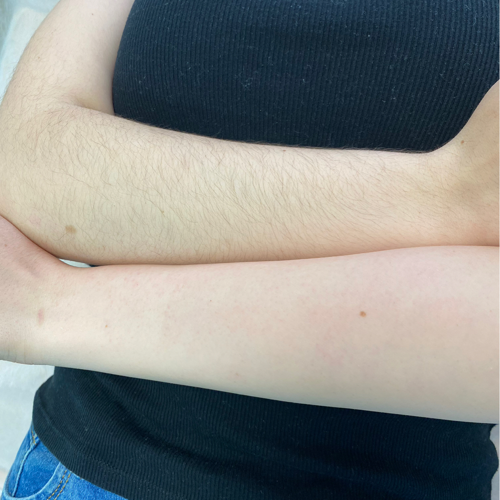 Руки полностью