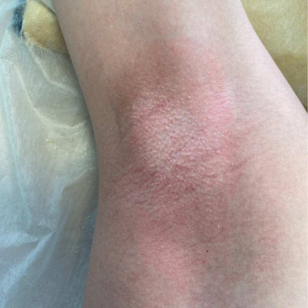 Подмышечные впадины