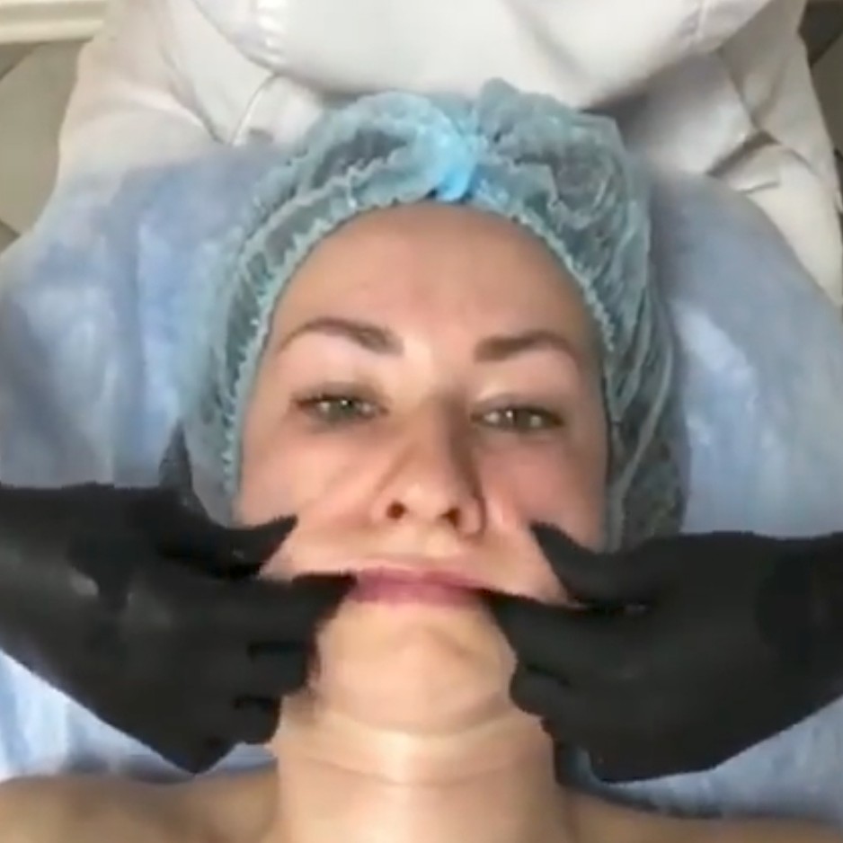 буккальный массаж лица