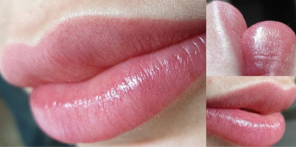 Липлайт  (lip light) — это процедура перманентного макияжа, суть которой заключается в нанесении светлых пигментов над верхней (арки купидона) и нижне