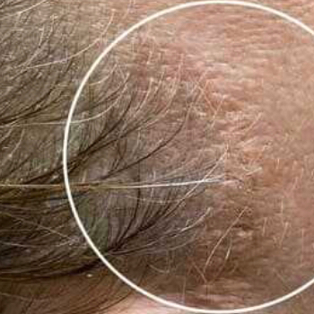 Коррекция камуфляжа