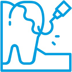 Chirurgie orală