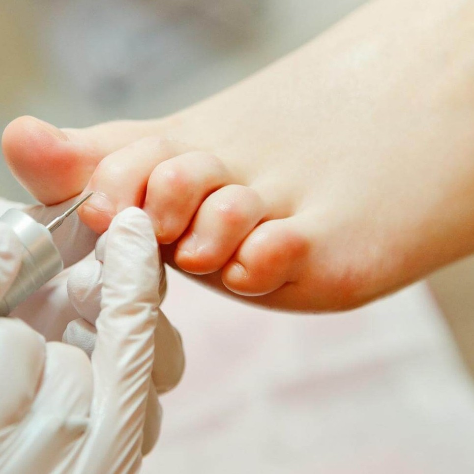 Педикюр без обработки стоп