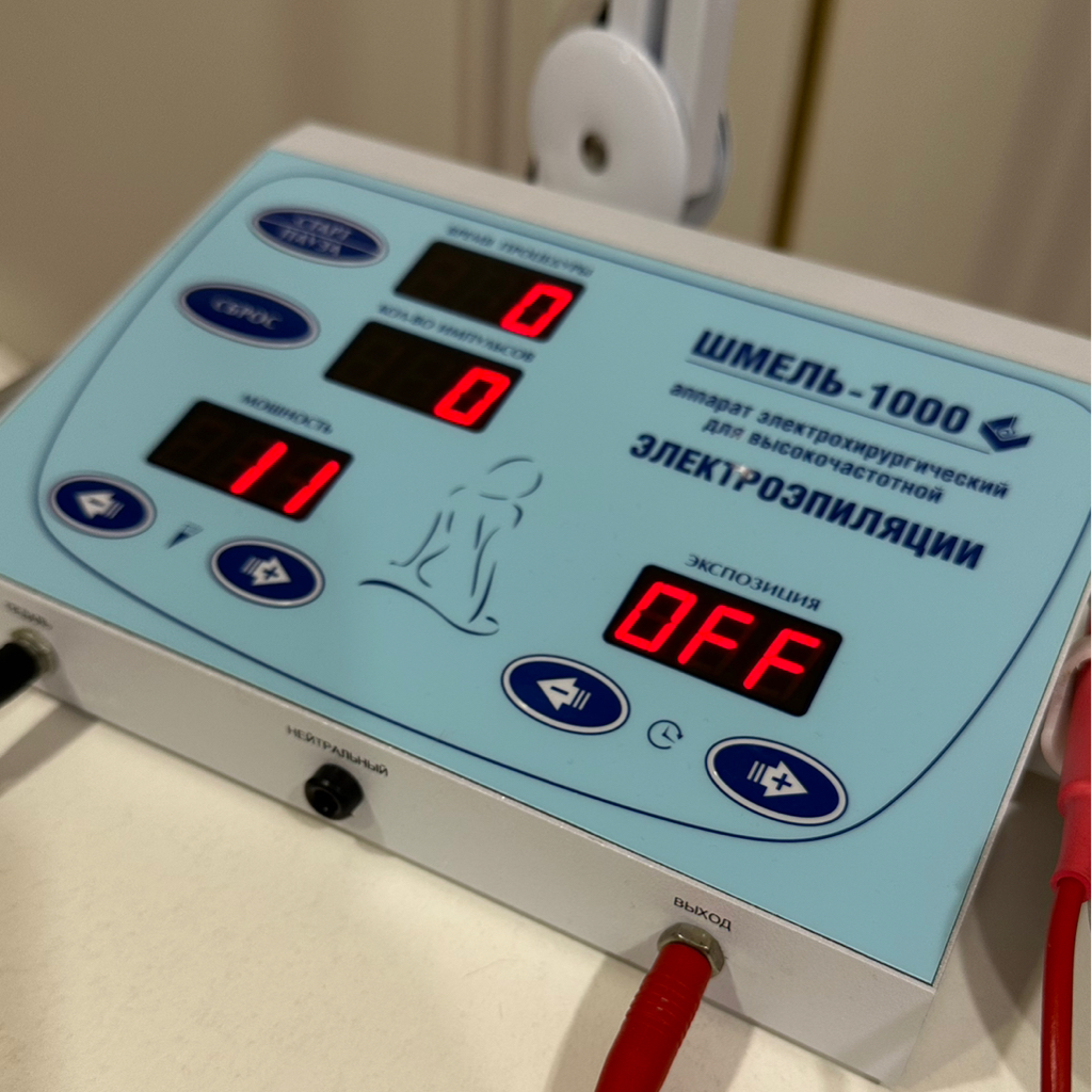 Электроэпиляция