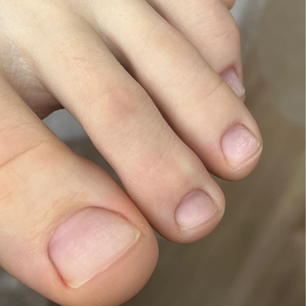 Педикюр эстетический