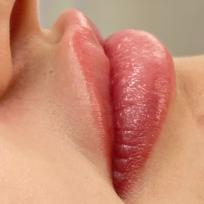 Над верхней губой