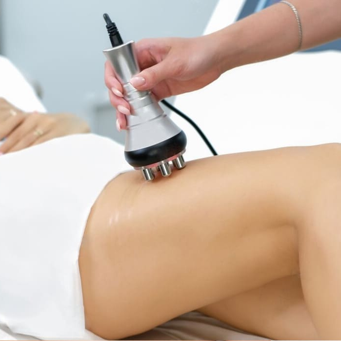 Rf-лифтинг тела