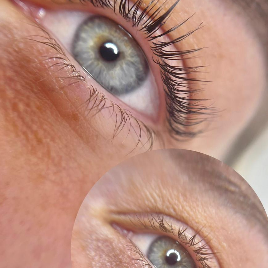 Eyelash Lift