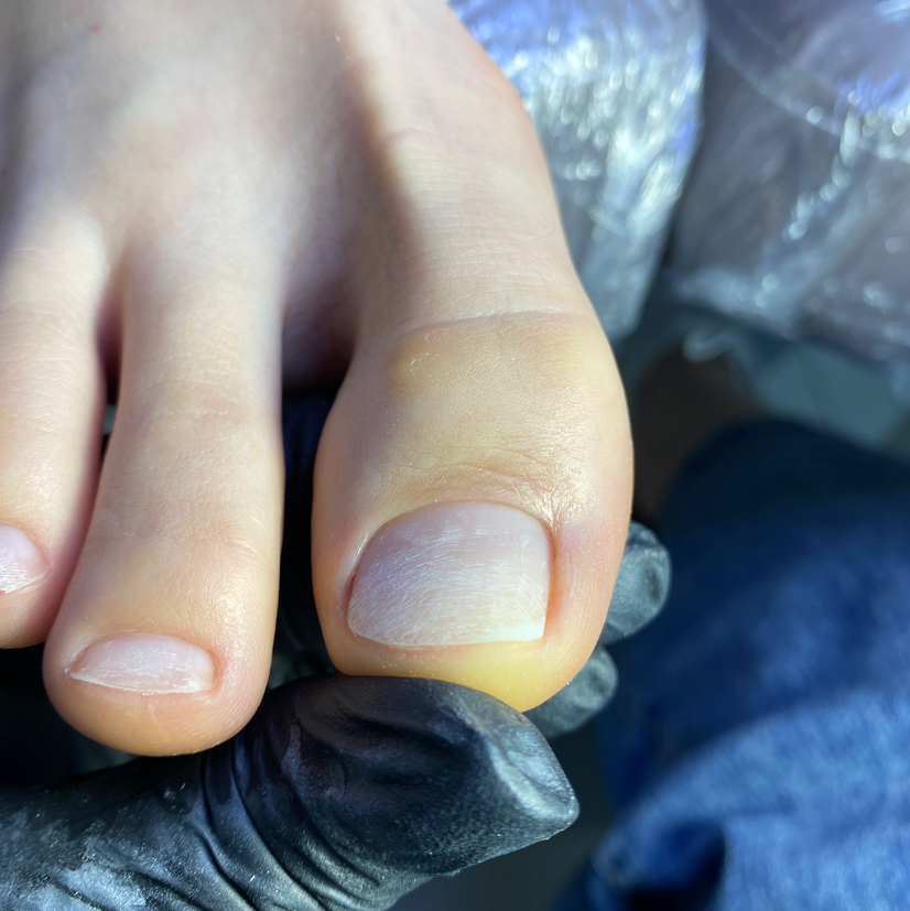 Обработка пальцев и ногтей